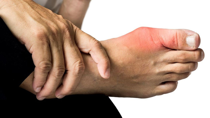 Triệu chứng của thoái hóa khớp